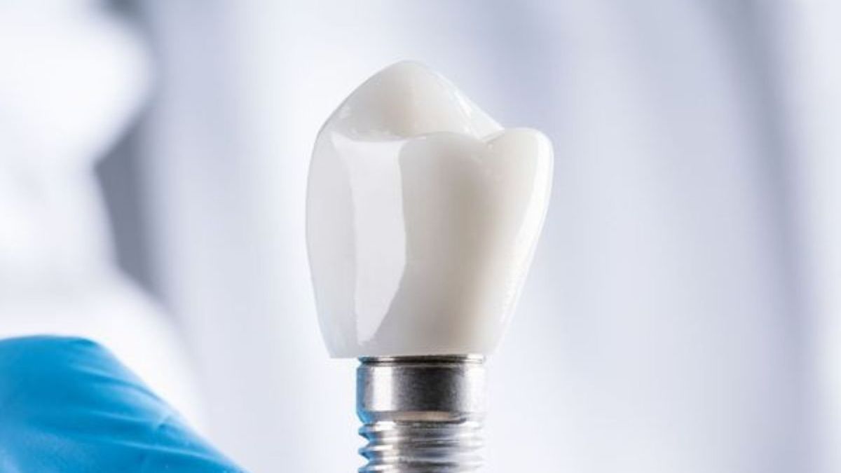 dentist holding tooth implant
