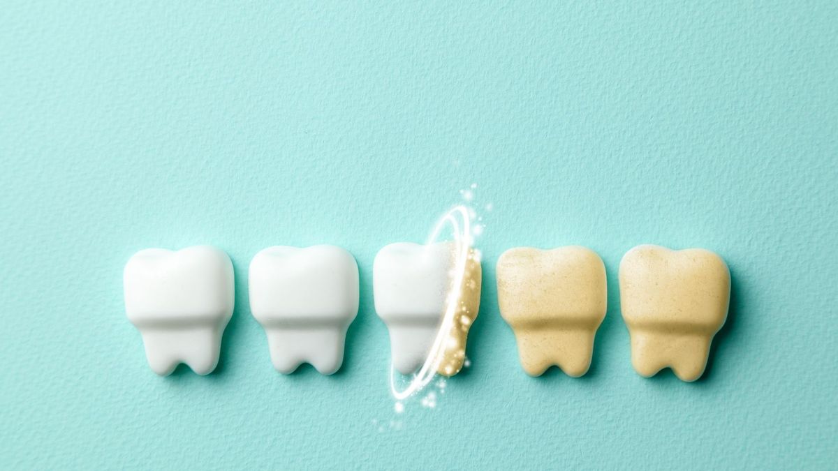 Picture of teeth in different shades of white