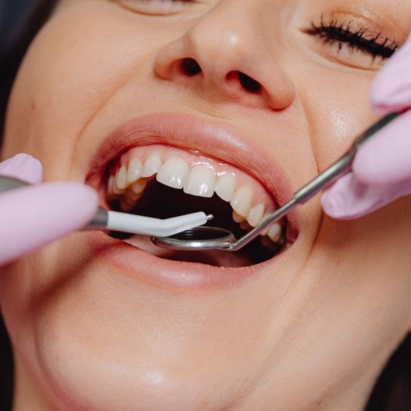 woman smiling during dental cleaning