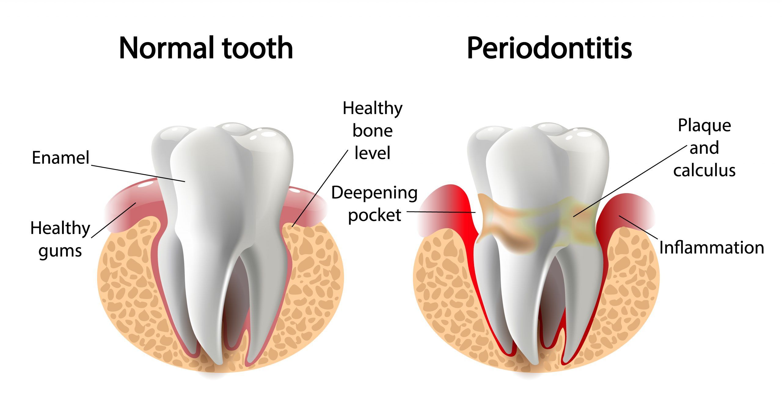 periodontalTreatment_lim-scaled.jpg