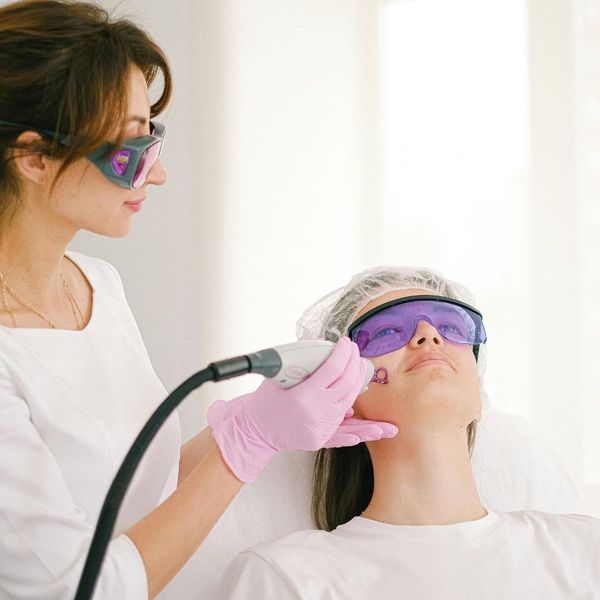 laser treatments on face