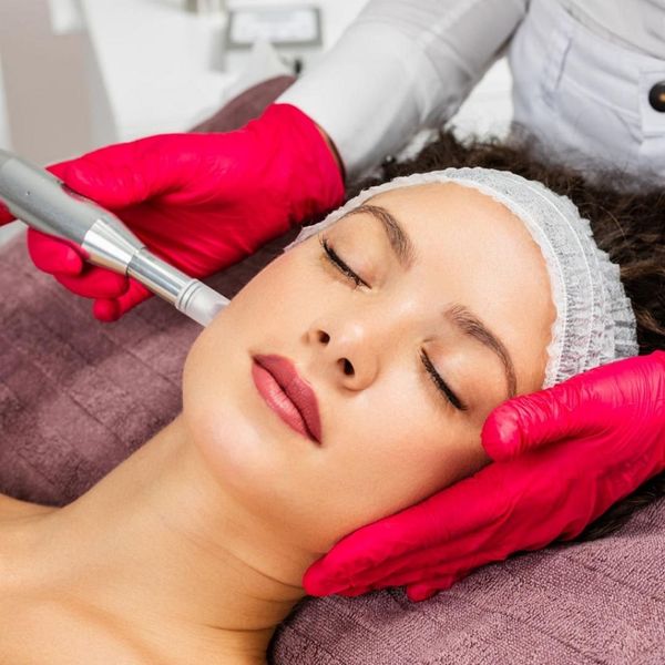 microneedling services