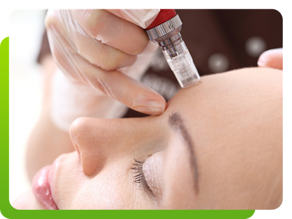 microneedling a woman's brow ridge