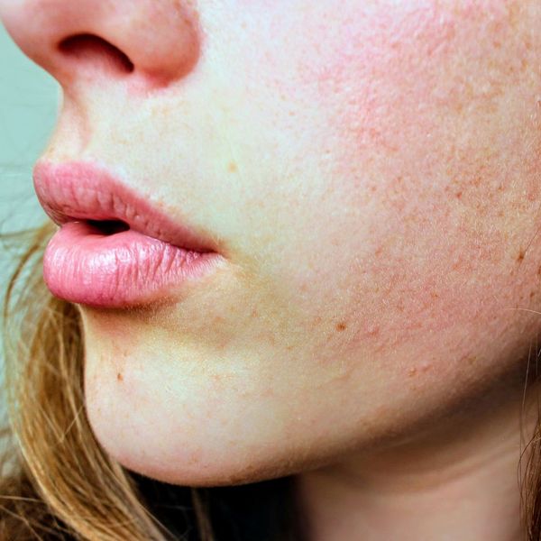 4 Signs Your Skin is Craving a Professional Facial (2).jpg