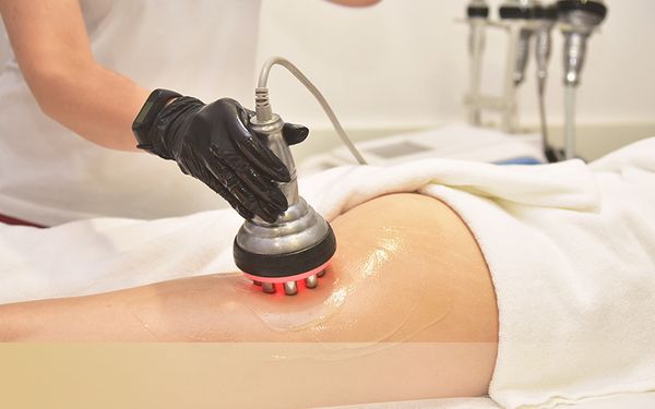 cryotoning on the back of a woman's leg