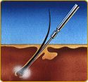 Illustration of Electrolysis