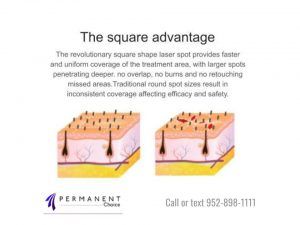 Diagram of the square advantage