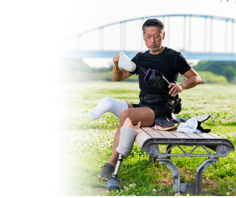 Hair removal for amputees with Permanent Choice Laser Hair Removal and Electrolysis Centers