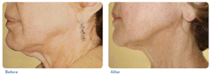 skintight 2.gif