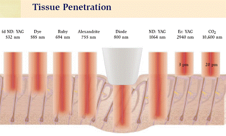 Diagram of Tissue Penetration during Laser Hair Removal