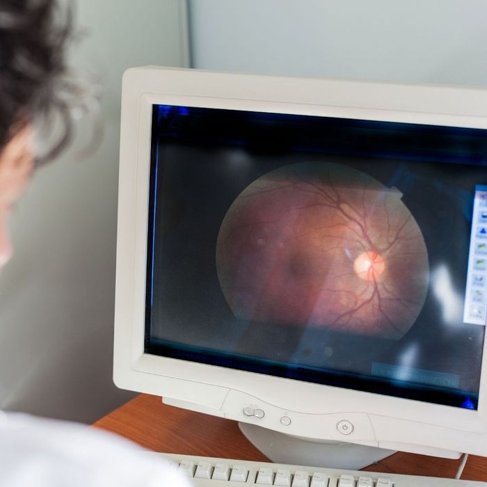 Image of a retina being examined on a computer
