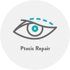 Ptosis Repair