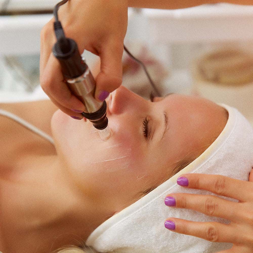 Microdermabrasion