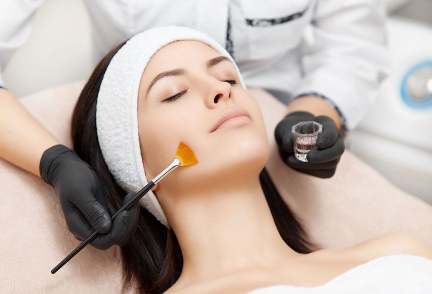 chemical-peels-1.jpeg