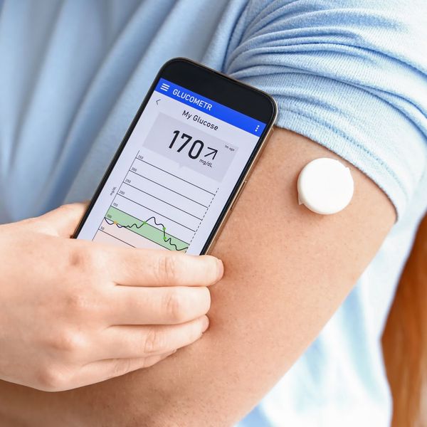 Real-Time Glucose Insights