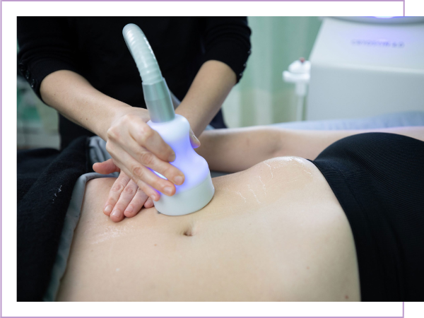 woman getting cool sculpting