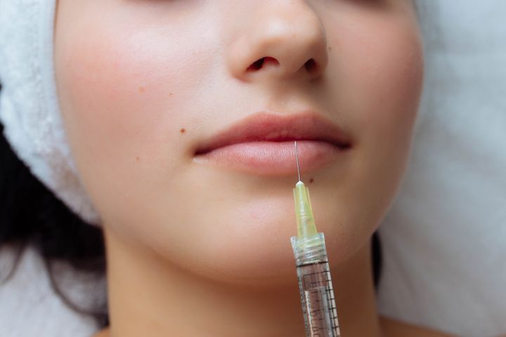sensual-female-lips-procedure-lip-augmentation-s-2023-11-27-05-13-27-utc.jpg