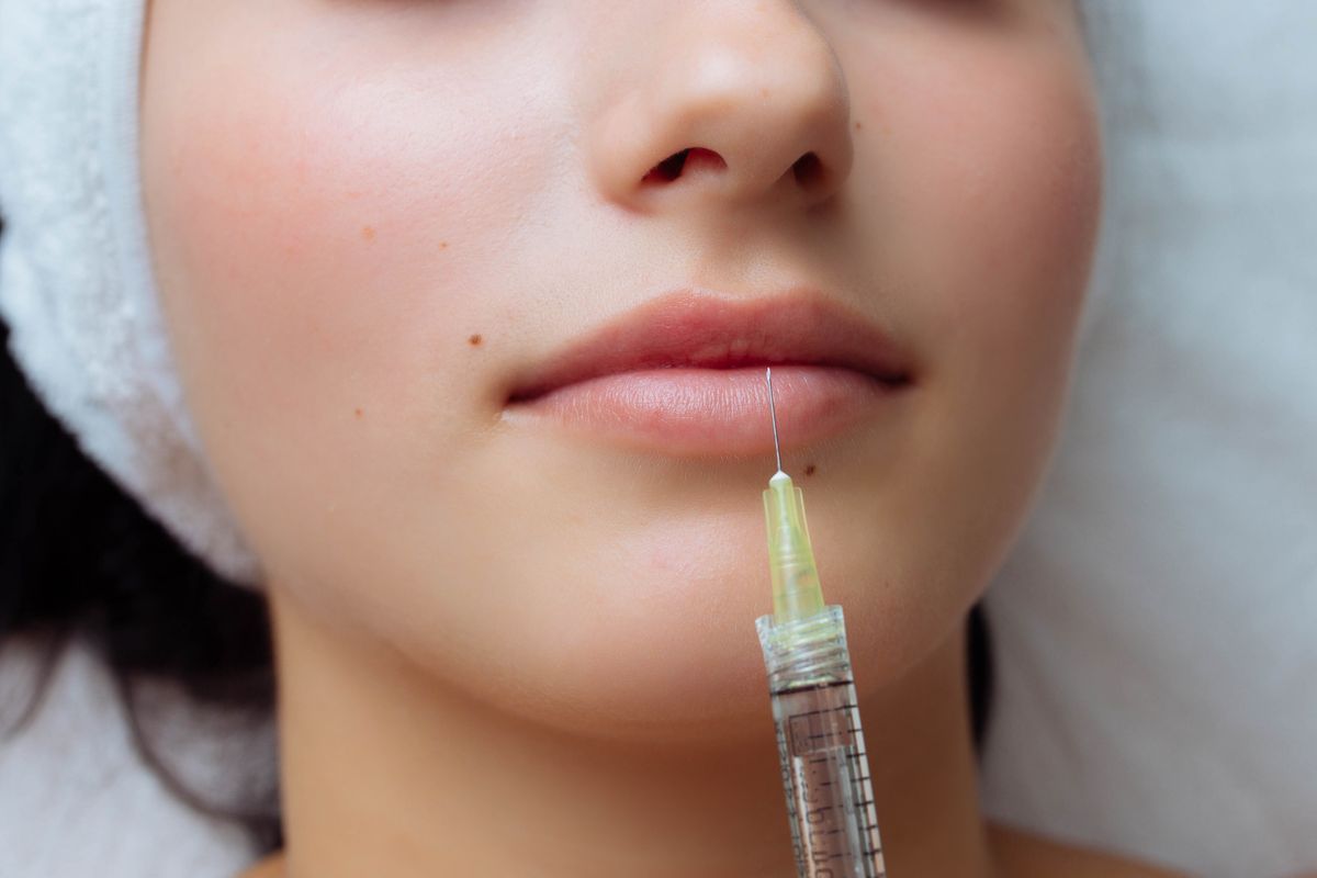 sensual-female-lips-procedure-lip-augmentation-s-2023-11-27-05-13-27-utc.jpg