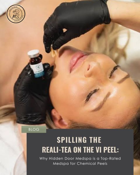 Spilling the Reali-TEA on the VI Peel (1).jpg