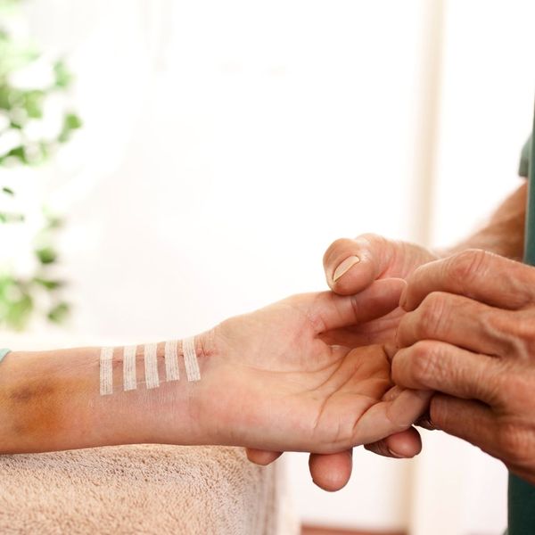 woman stretching out bandaged hand from surgery