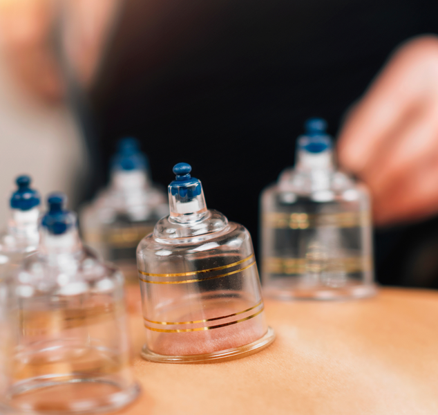 cupping