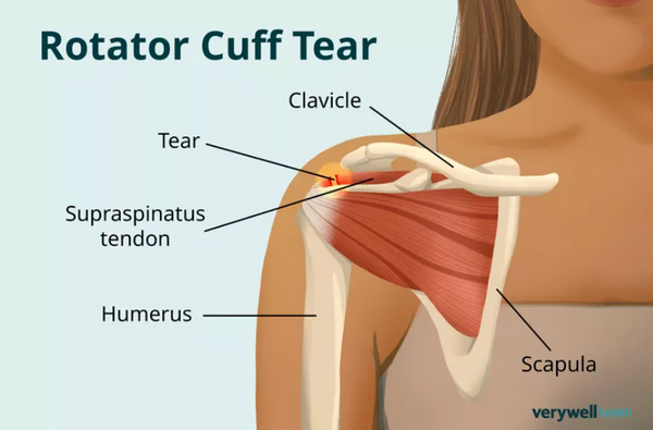 Screenshot 2025-11-20 at 9.07.00%E2%80%AFPM.png