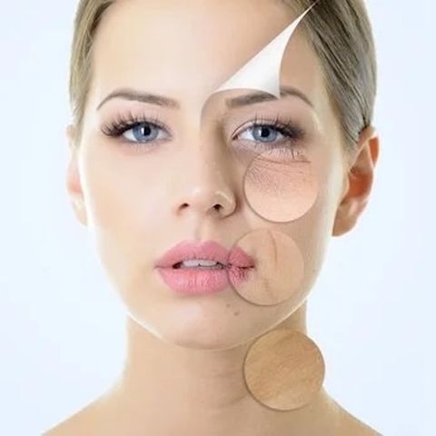 chemical-peels-benefits.jpeg
