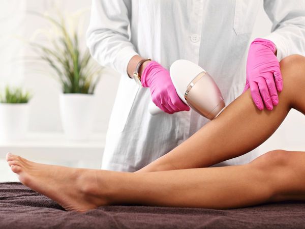 laser hair removal image