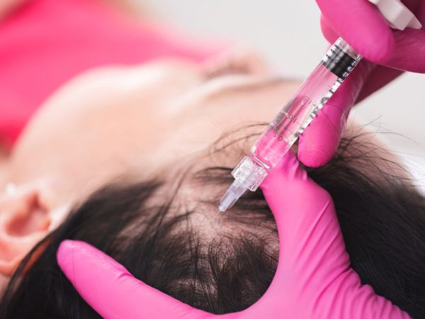 hair loss injection image