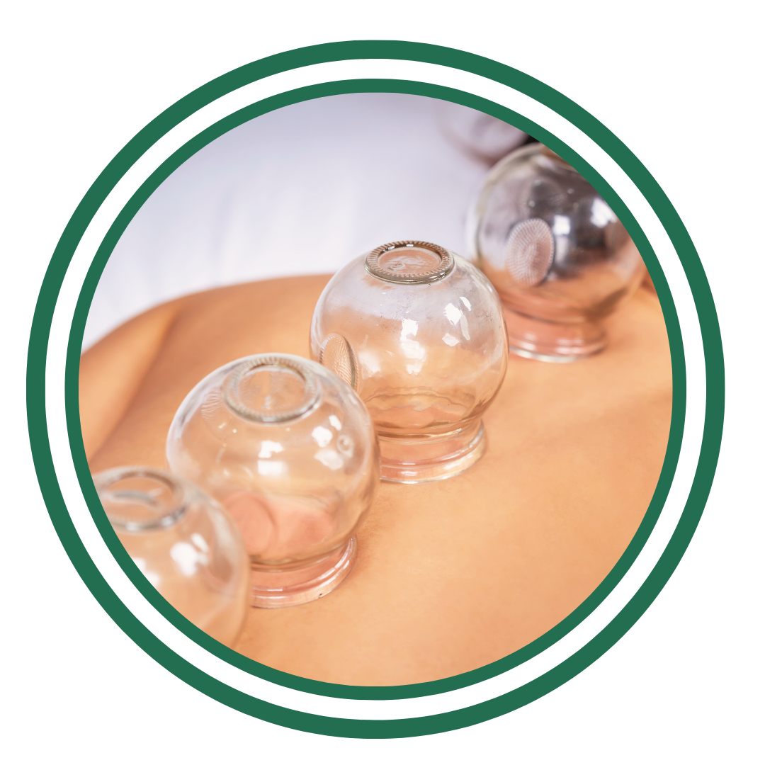 Sports Cupping.png