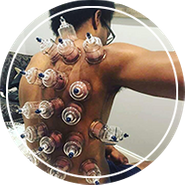 Sports Cupping Therapy for Recovery: Man Receiving Treatment on Massage Table