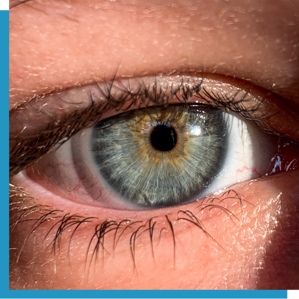 closeup of eye 