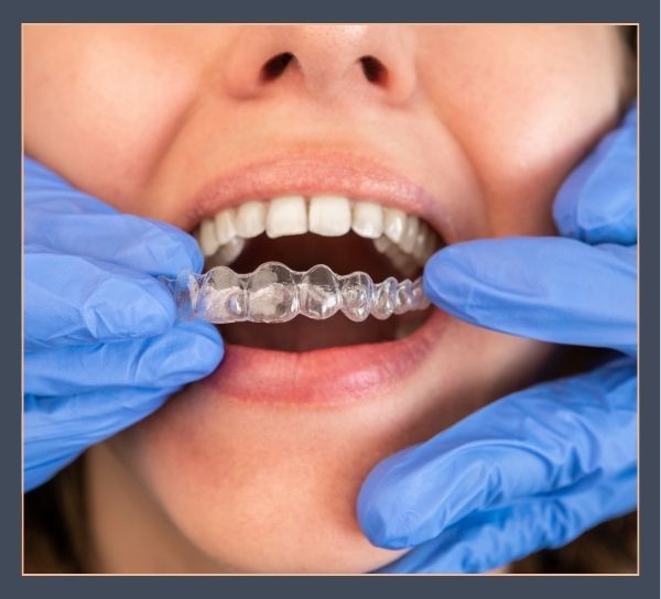 Martha Lake Invisalign-img3.jpg