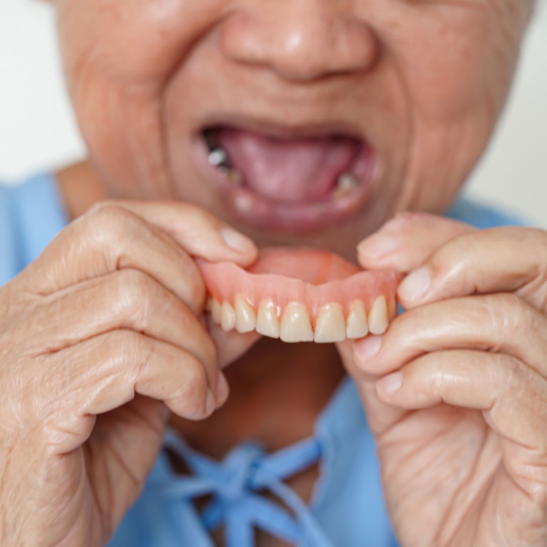 Dentures being placed into a mouth