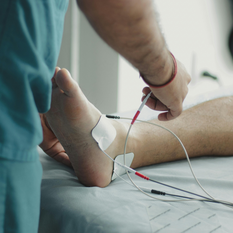 electro therapy being done on a foot electro therapy being done on a foot