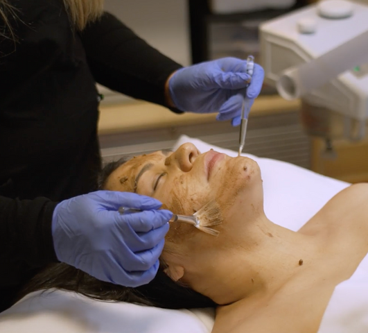 Facial.png