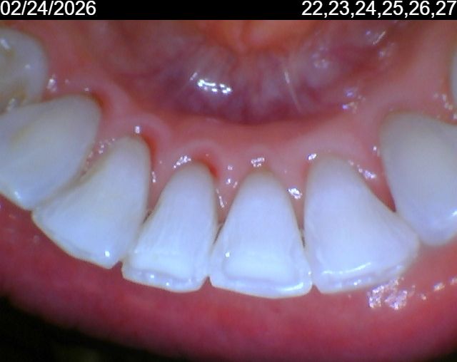 Carla 02_24_2026 22,23,24,25,26,27.jpeg