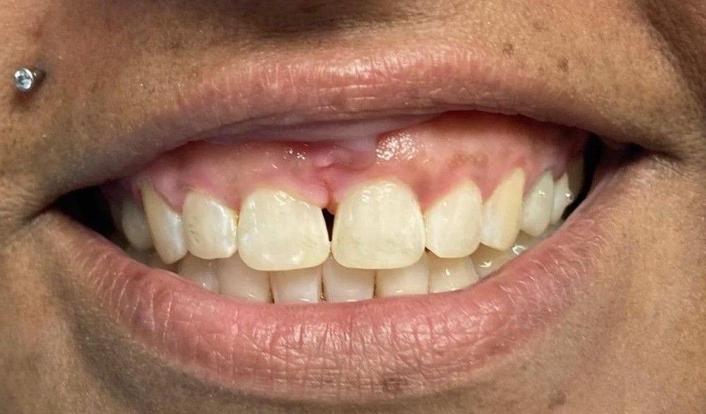 Crystal 02_01_2024_after2.jpeg