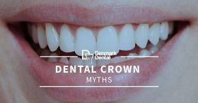 Dental-Crown-Myths-5cab88e676bd0-280x146.jpg