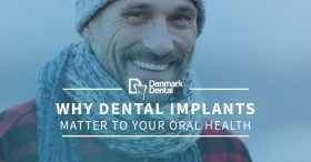 Why-Dental-Implants-Matter-To-Your-Oral-Health-5c25497cc8741-280x146.jpg