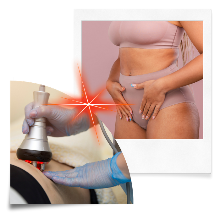 CONTACT AURA B'LASER SPA TODAY!.png