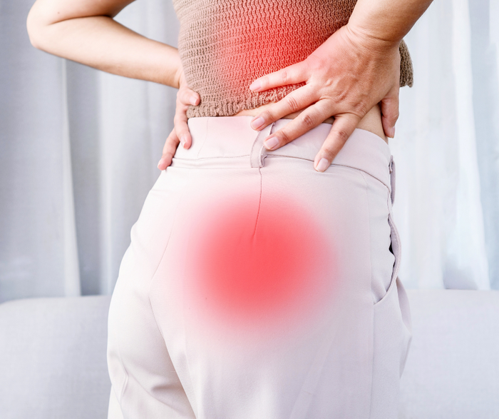 Physical Therapy for Sciatica