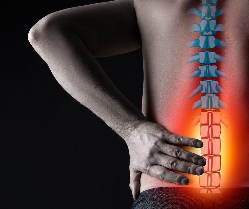 Physical Therapy for Sciatica