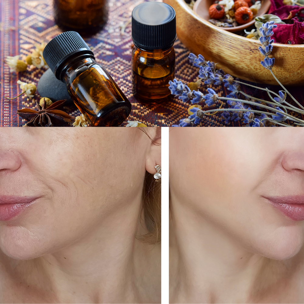 best essential oils for younger looking skin
