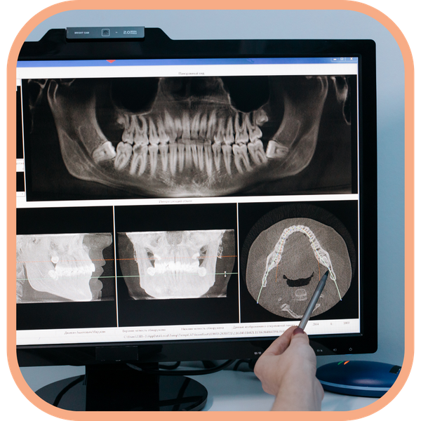 Corrective Jaw Surgery - Image 3.png