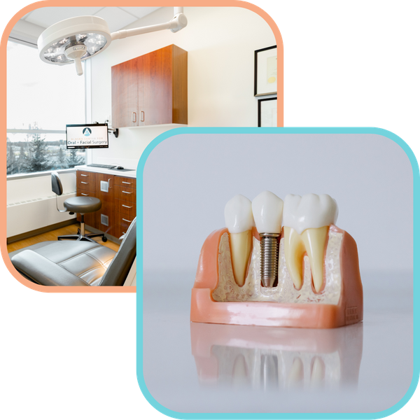 DentalImplants-img1.png