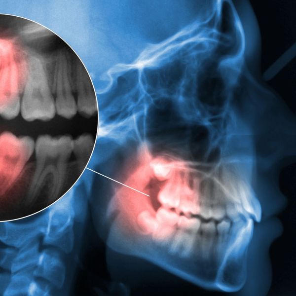 The Science Behind Facial Surgery_IMG-4.jpg