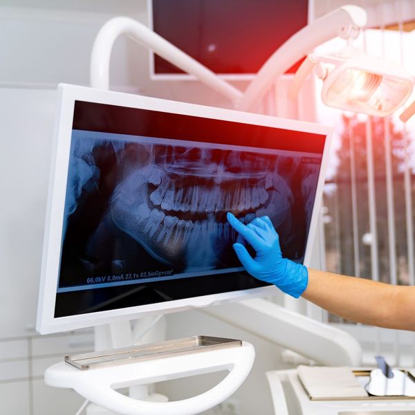 Addressing Unique Oral Surgery Challenges And Considerations For Seniors 1.jpg