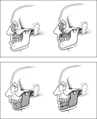 conditions of jaws.jpg