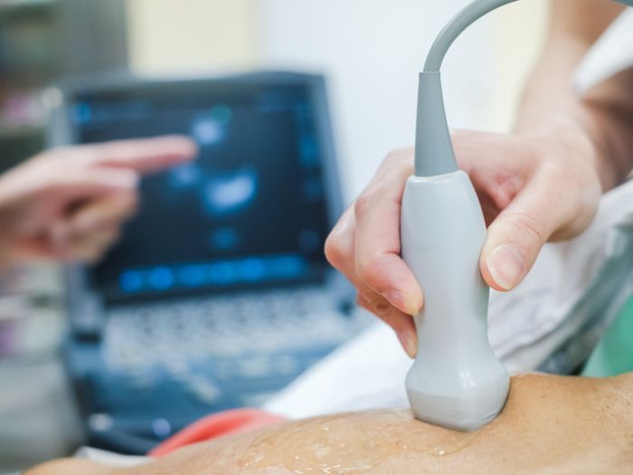 An echocardiogram being performed